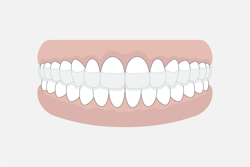 矯正歯科について